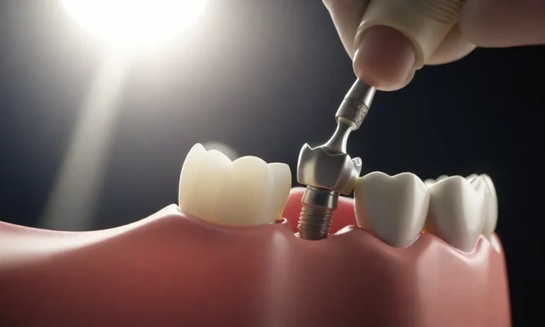 What Glue Do Dentists Use For Crowns? A Comprehensive Guide
