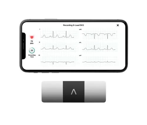 6-Lead Detailed Portable EKG